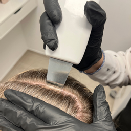Čistenie pokožky hlavy vysokofrekvenčnou ultrazvukovou špachtlou