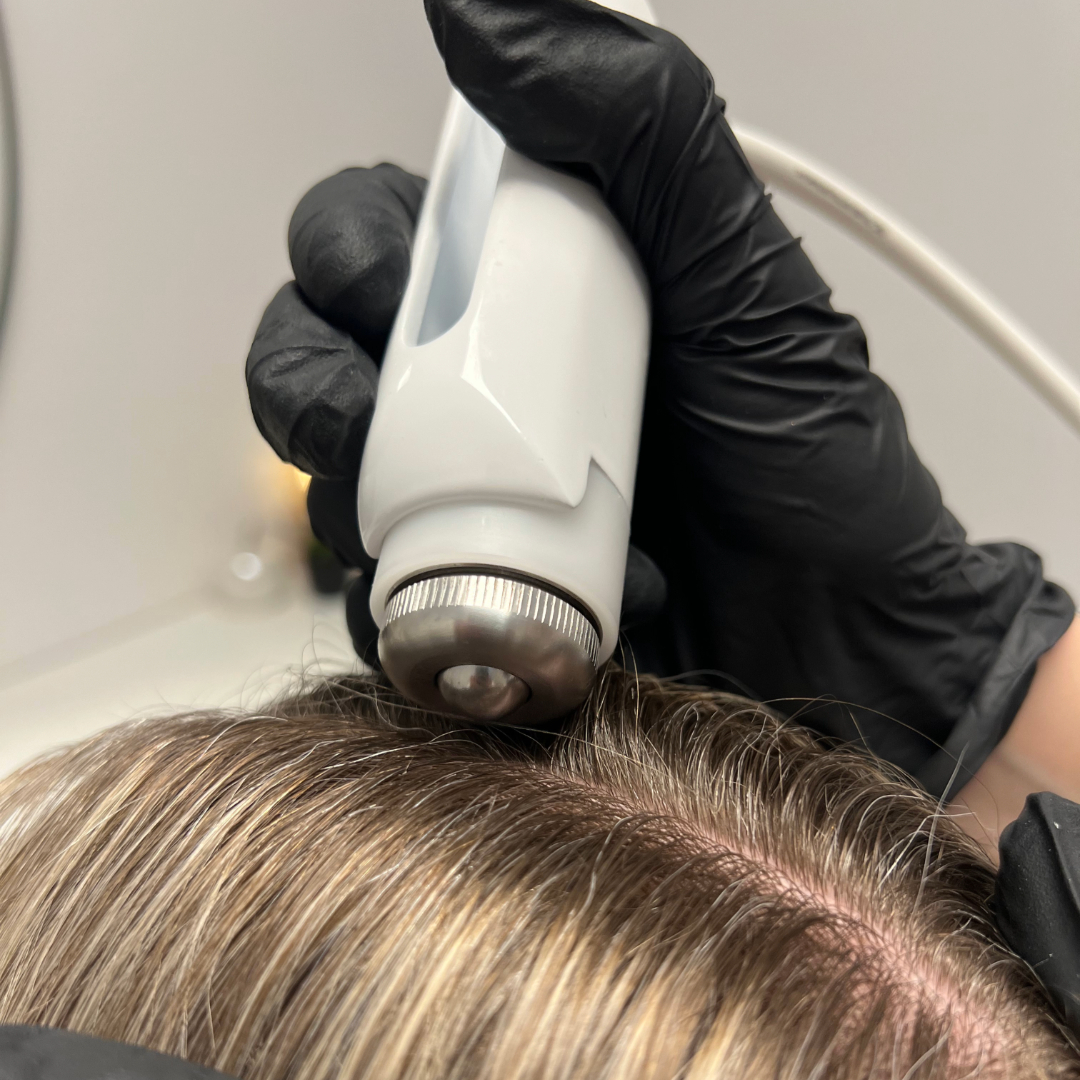 Čistenie pokožky hlavy s aplikáciou séra NEOHAIR elektroporáciou