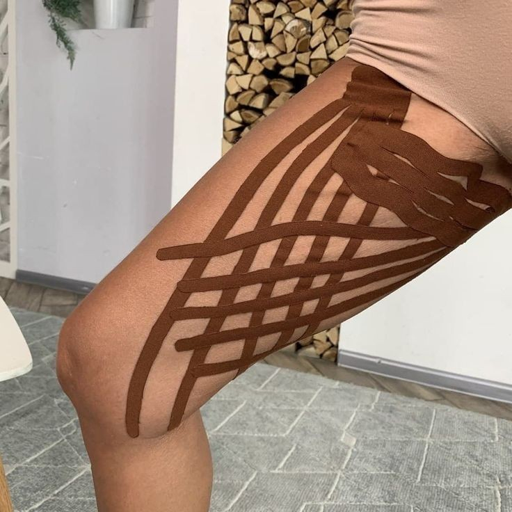 Kinesio-Tape ragasztás