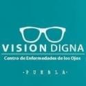 Vision Digna