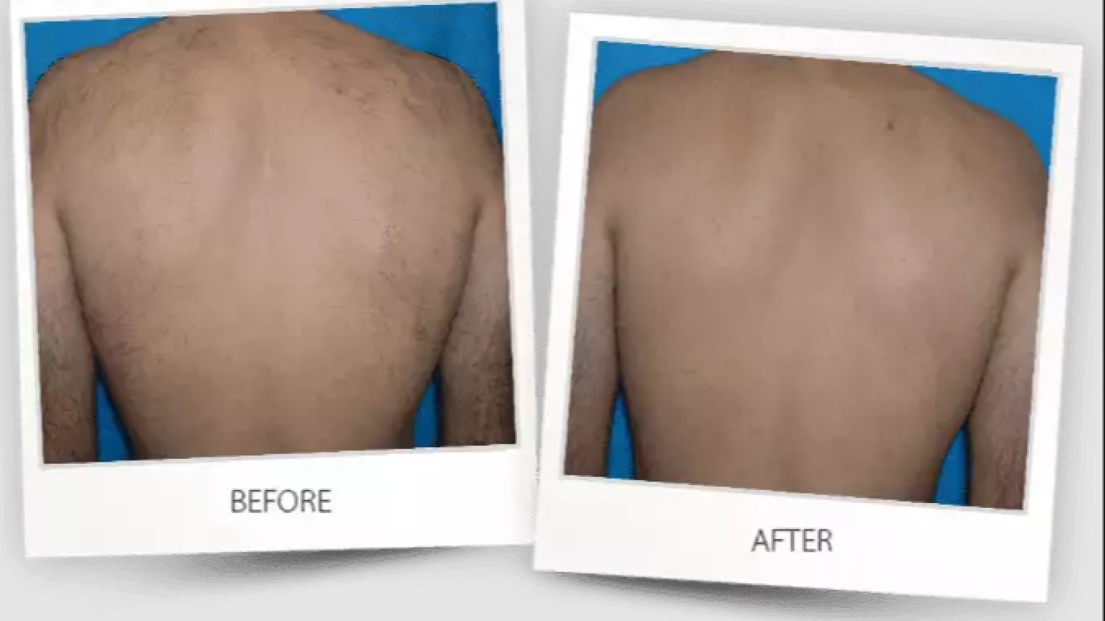Spitale Laser Spa Salon