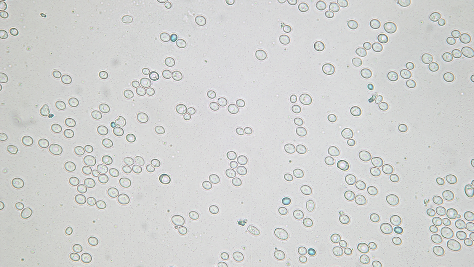 Budějovický Budvar – Výdej kvasnic