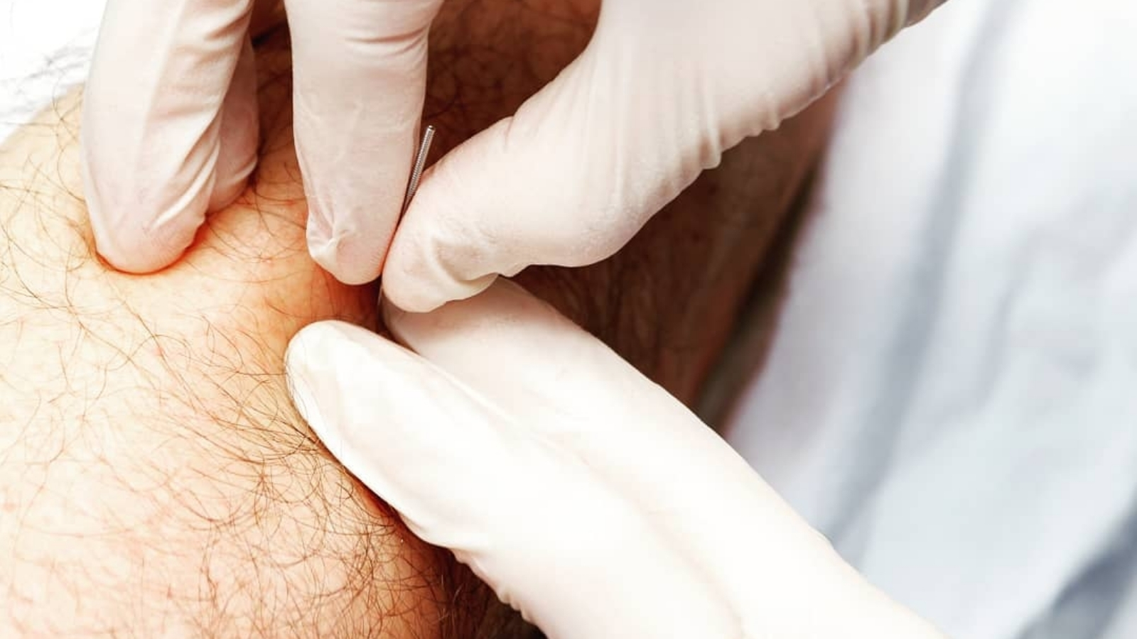 Atlas Fisioterapia Mungia