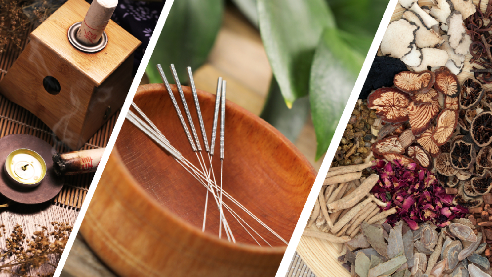 Čínská medicína Bruntál - Zdeněk Kozub