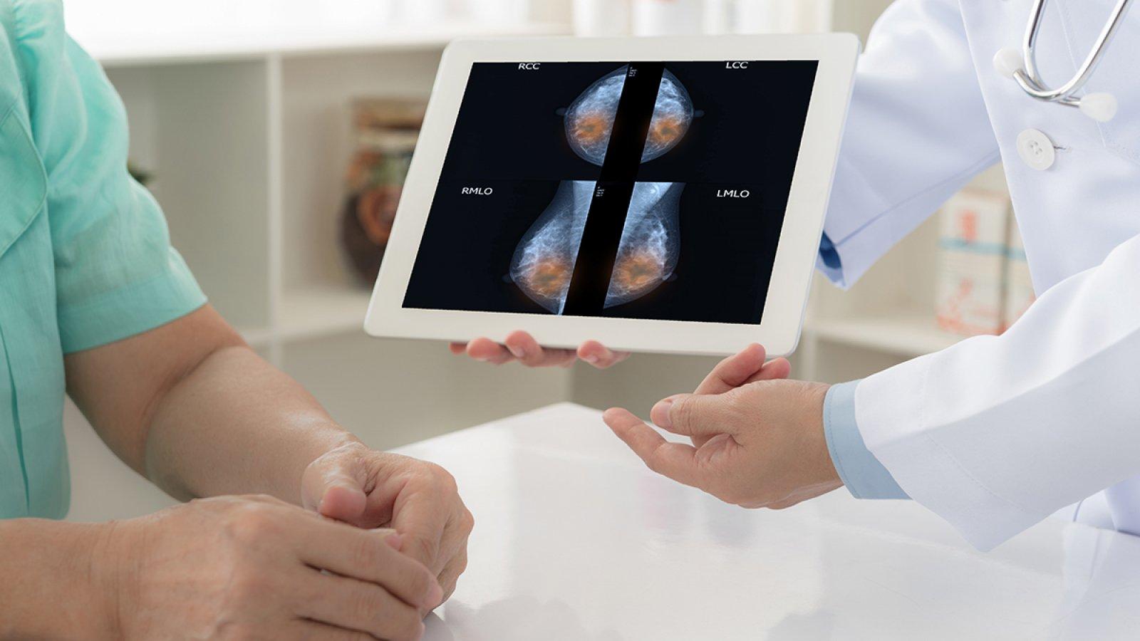 Mamografické vyšetření