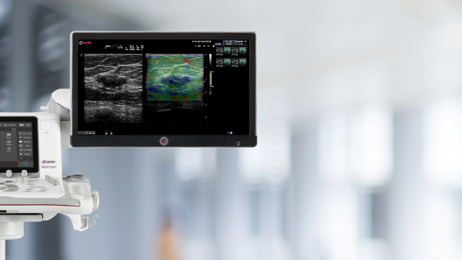 Ecografias Barcelona