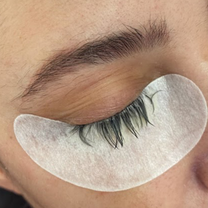 Remoção de Extensão