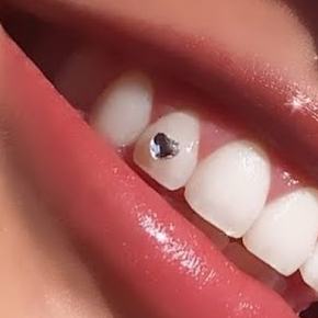 Strass dentaire forme