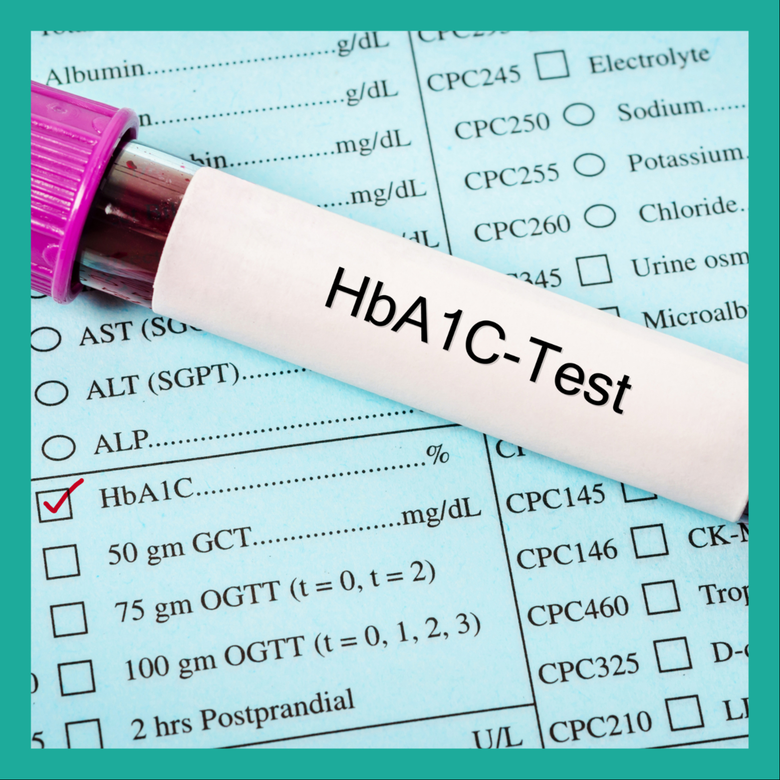 Meranie Glykovaného hemoglobínu HbA1c