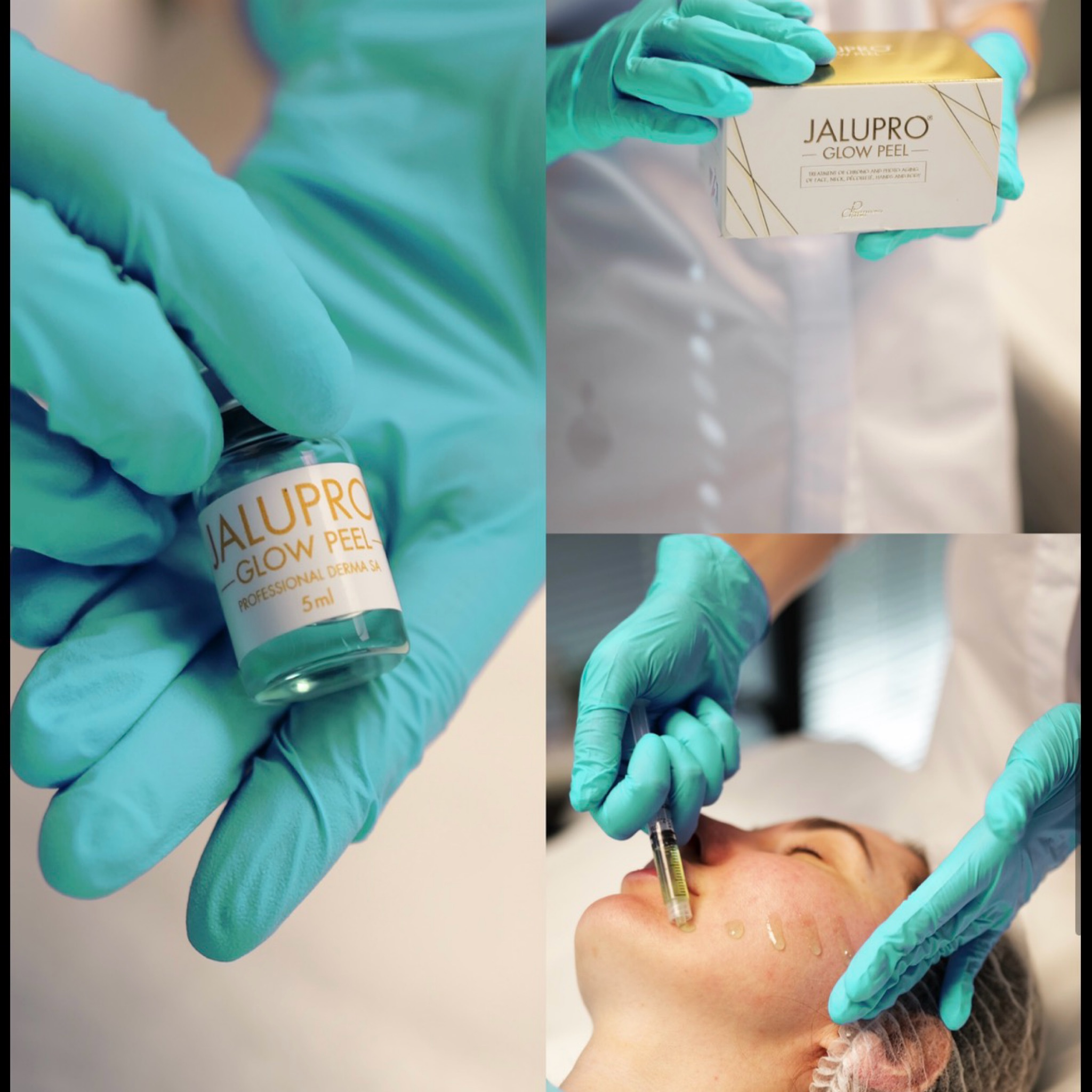 Mikrojehličky s JALUPROGLOWPEEL