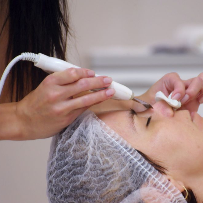 VYČIŠTĚNÍ PLETI ULTRAZVUKEM