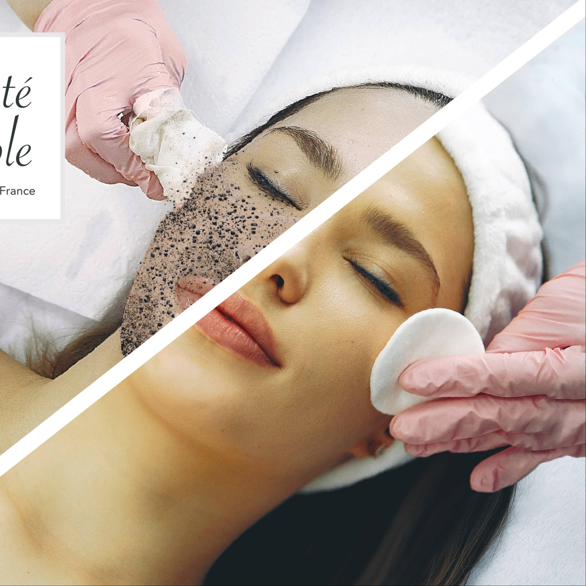 Microdermabrasion végétale