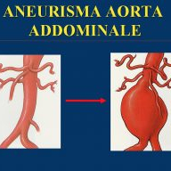 Grossi Vasi Addominali