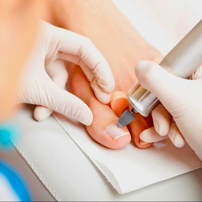 Shellac / Gel Modellage entfernen