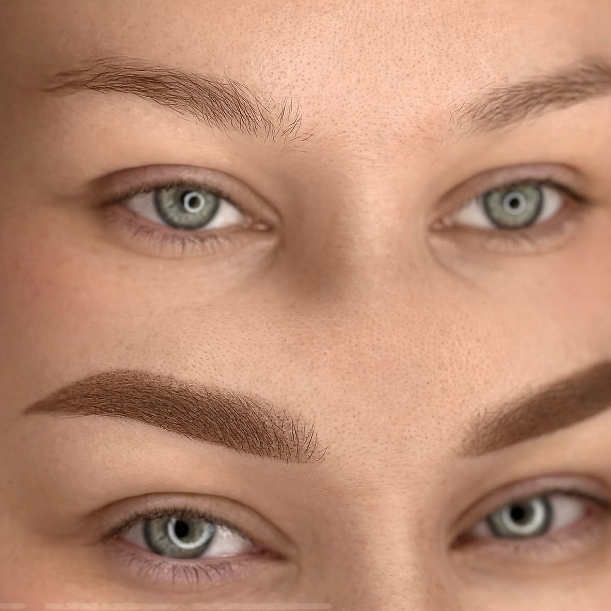 REFRESH obočia (do 1. roka)