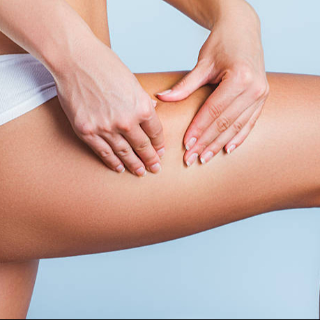 Soin anti-cellulite fesses + cuisses + genoux