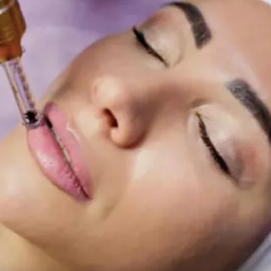 Zvětšení a vyživení rtů - hyaluron pen