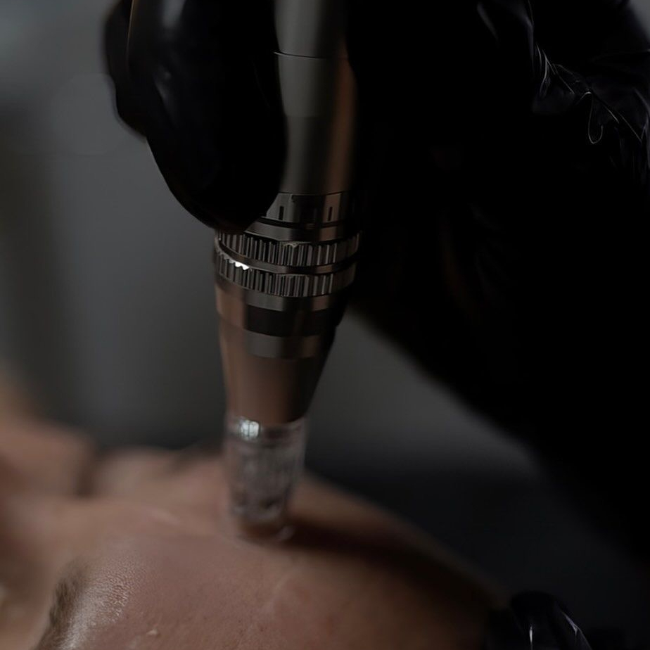 NanoNeedling - Tvár