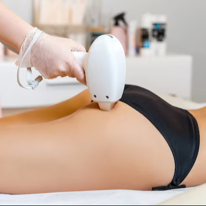 Depilação a Laser SHR Glúteos(Homem)