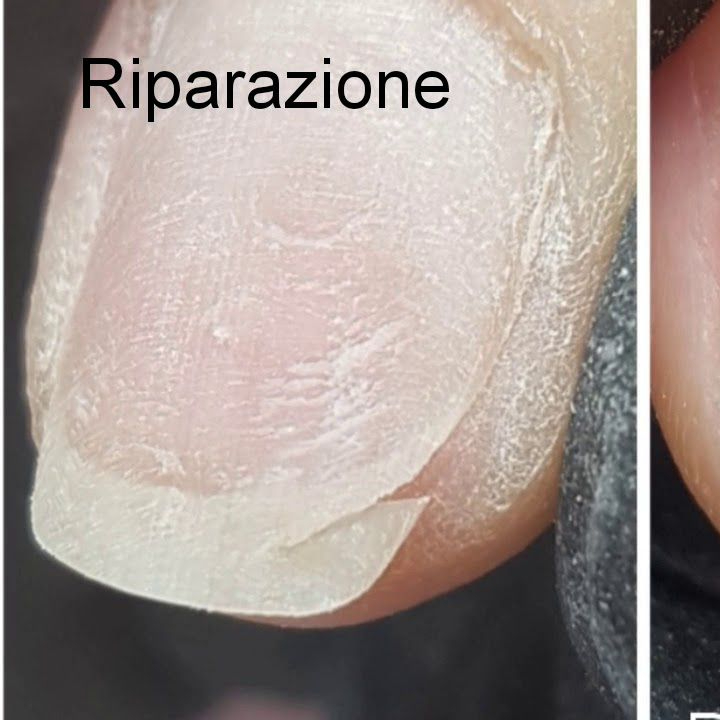 Riparazione 2 Unghie Semipermanente