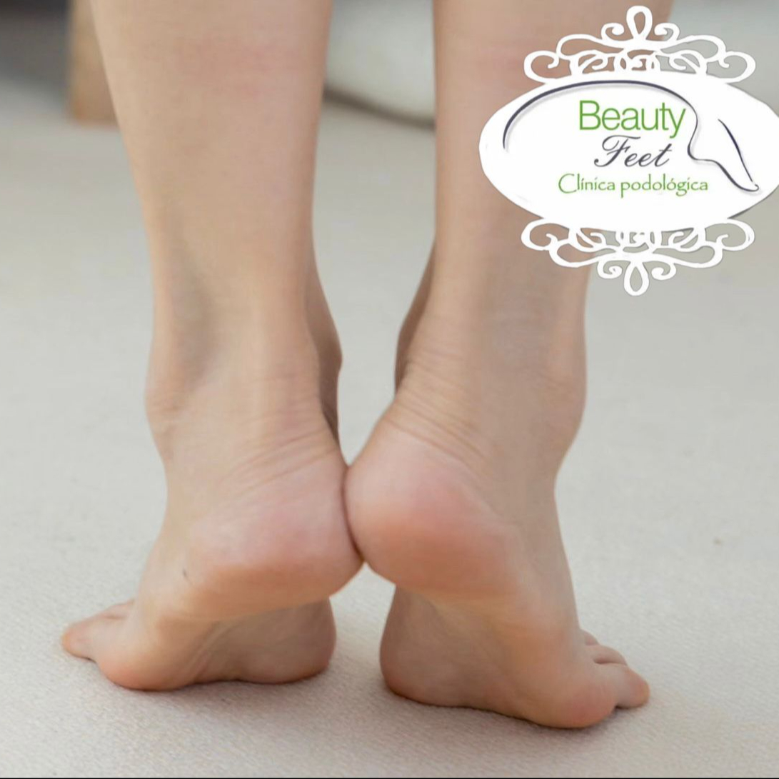 Desbridacion de Talones