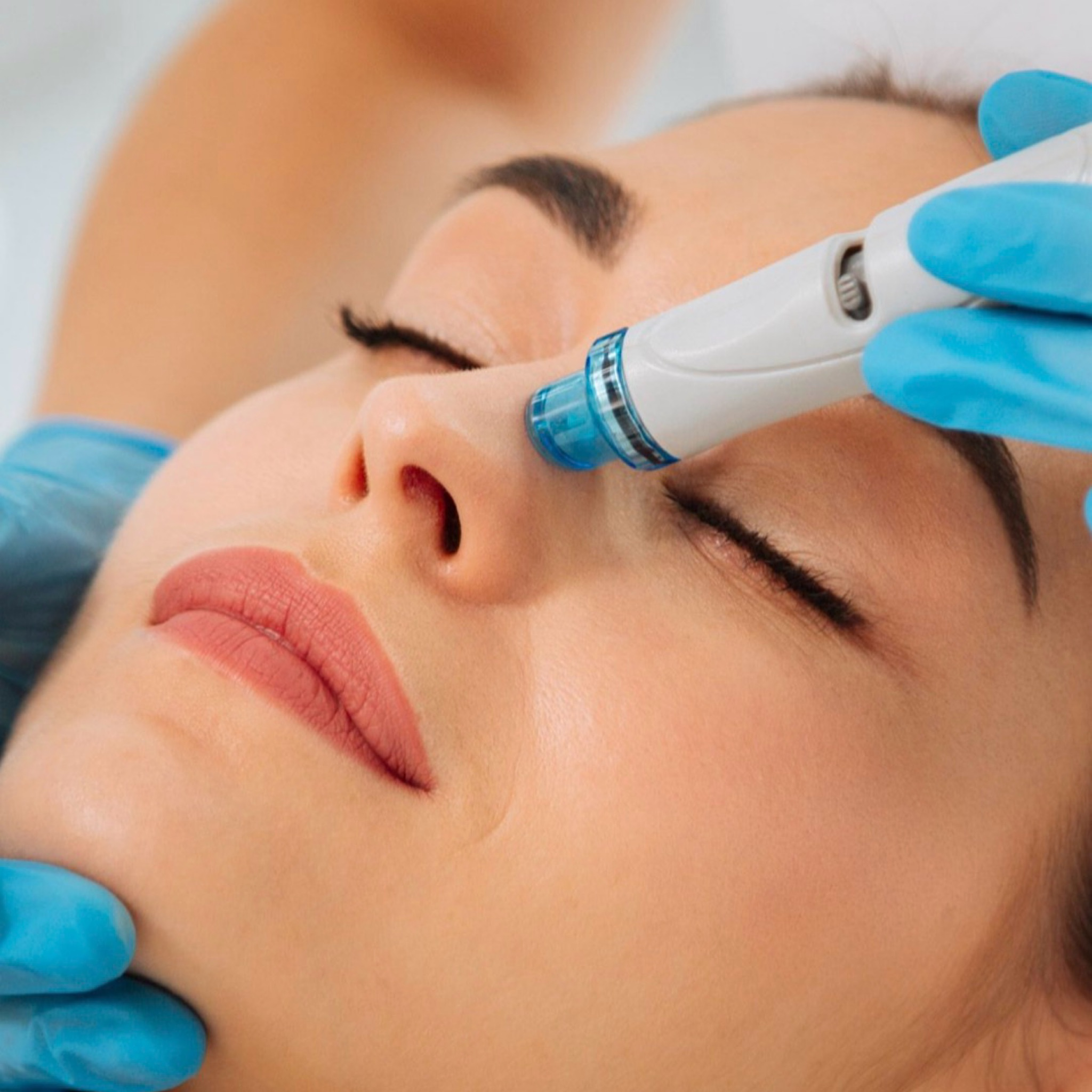 Hydra facial ( limpieza profunda)