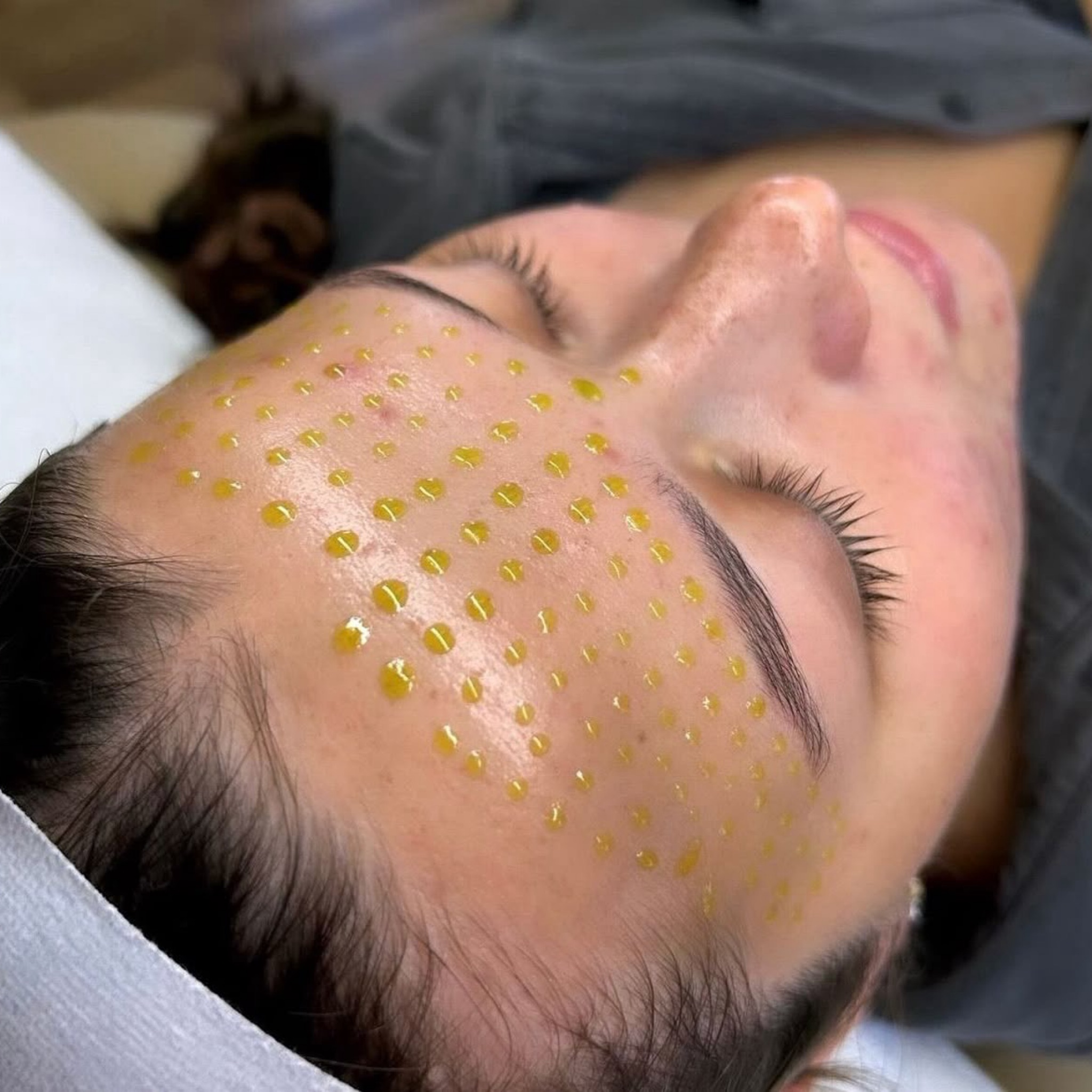 JaluPro Glow Peel