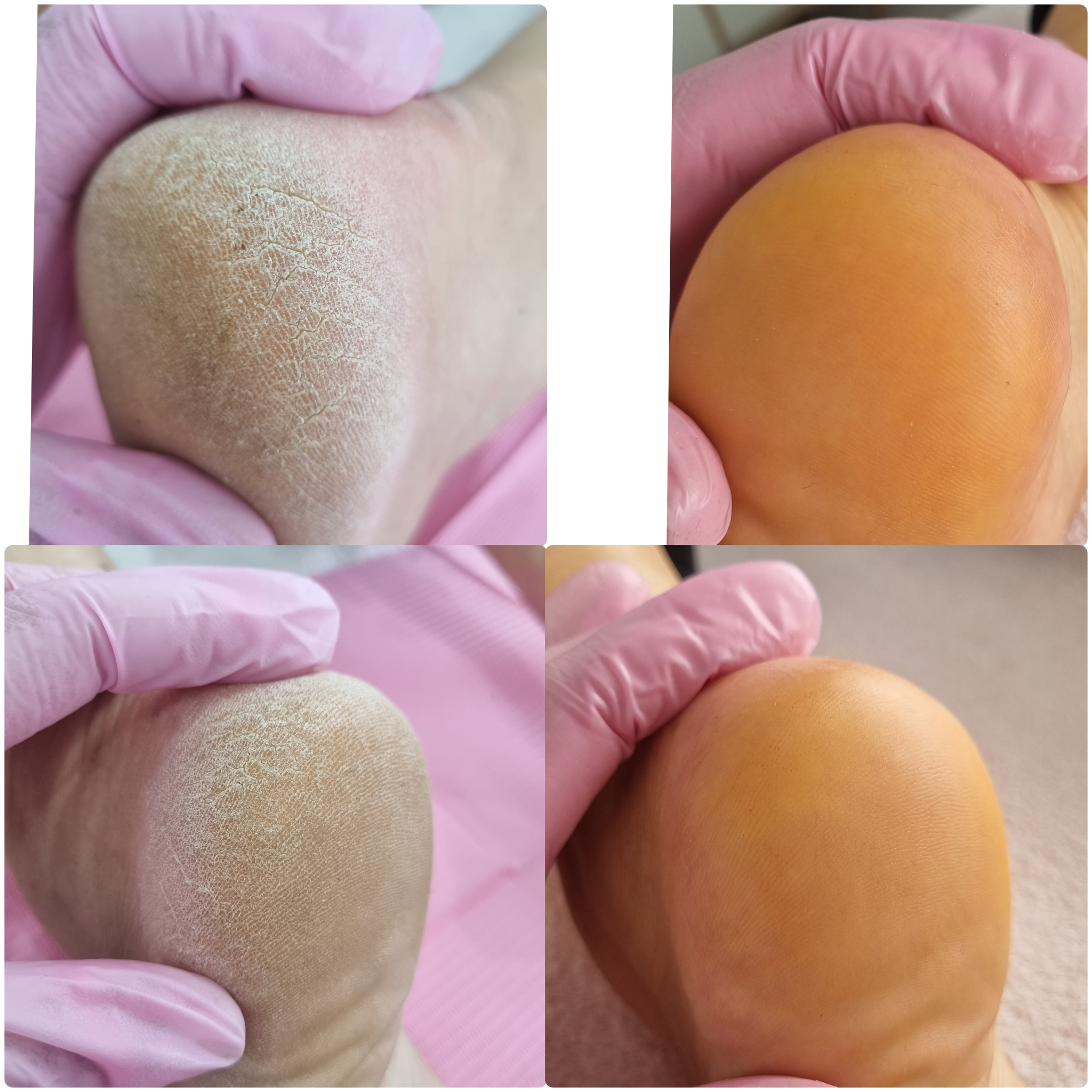Beauté des pieds pediluxe