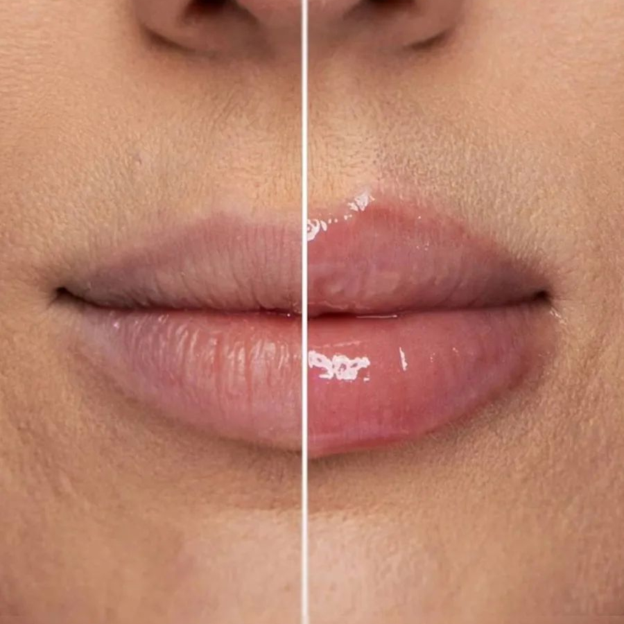 HYDRA LIPS PRONTA