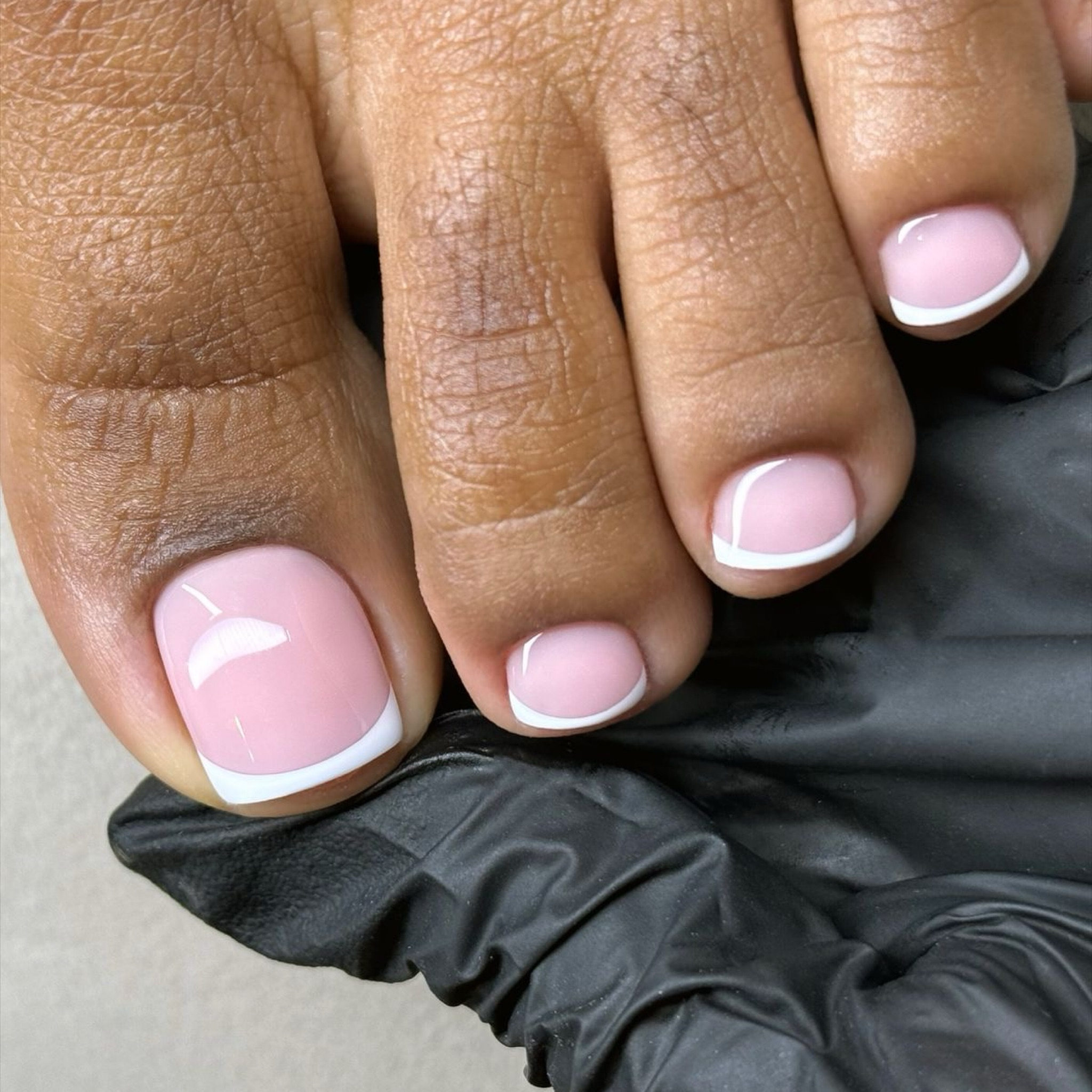 Remplissage gel