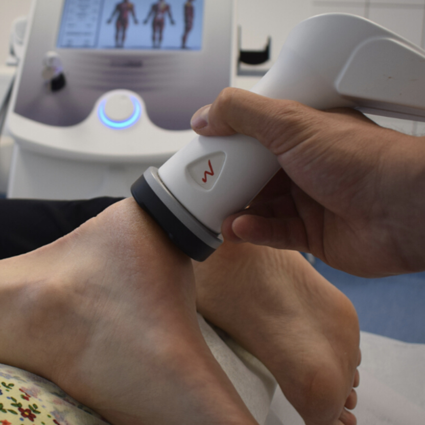 Odstránenie pätovej ostrohy (20 min)