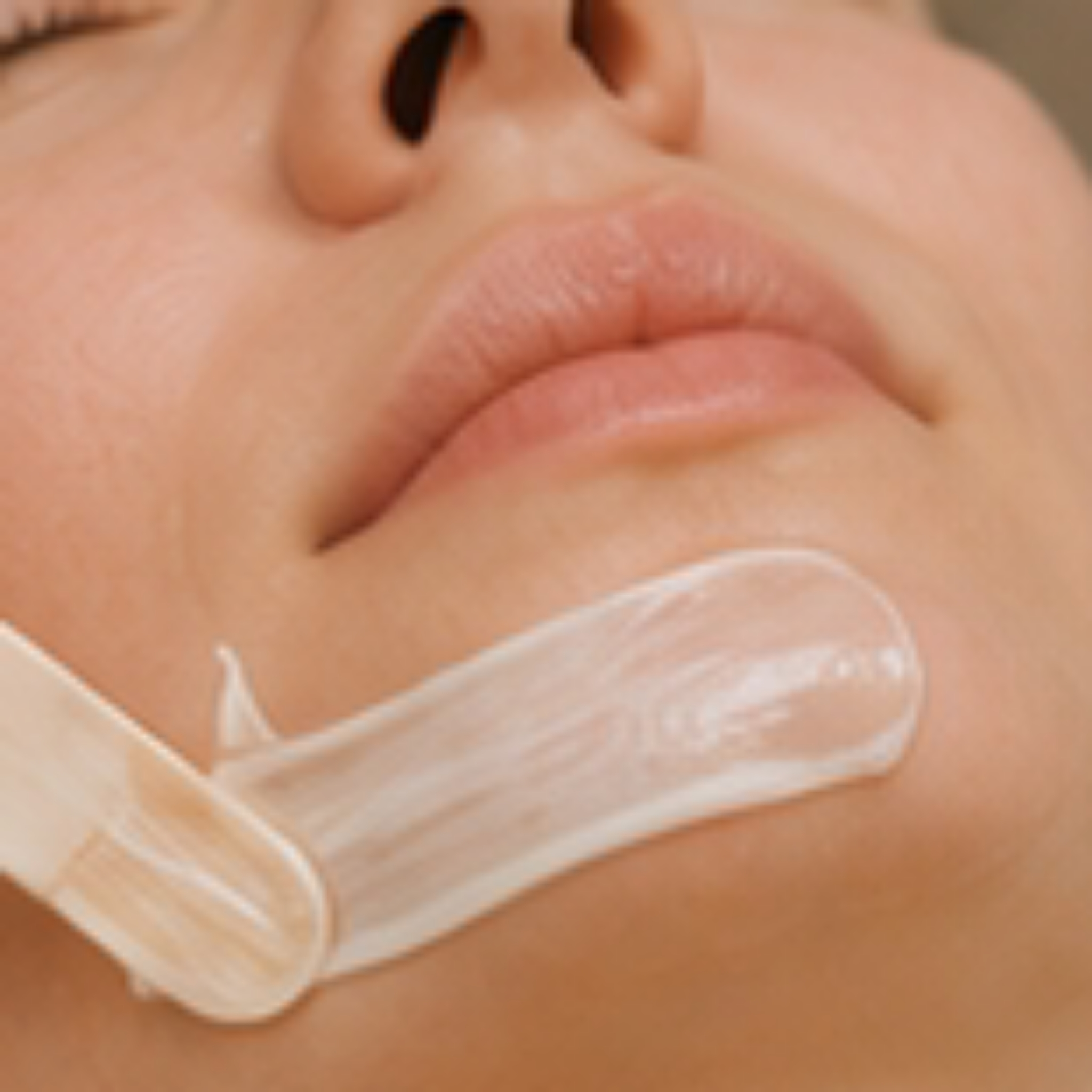 Epilation Menton