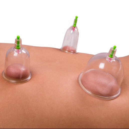 Baňkování + aku ucha + reiki