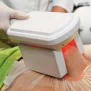 Criolipolisi Interno Braccia