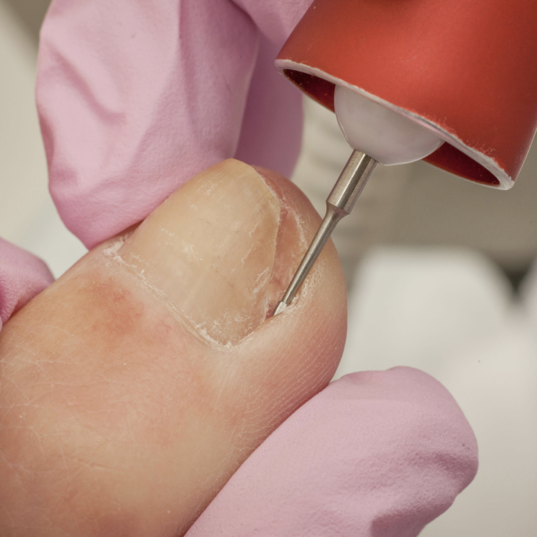 Speciální ošetření