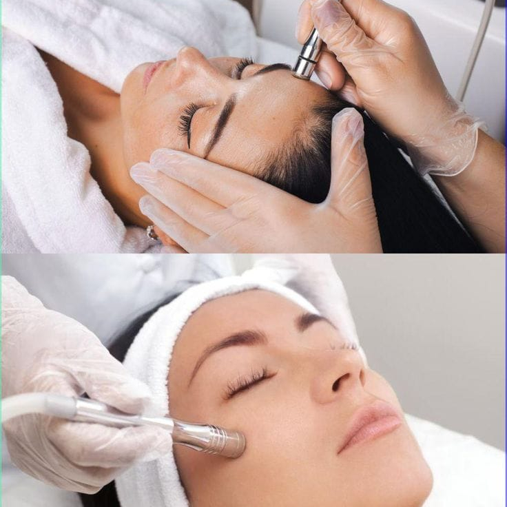 Limpieza Profunda Microdermabrasion