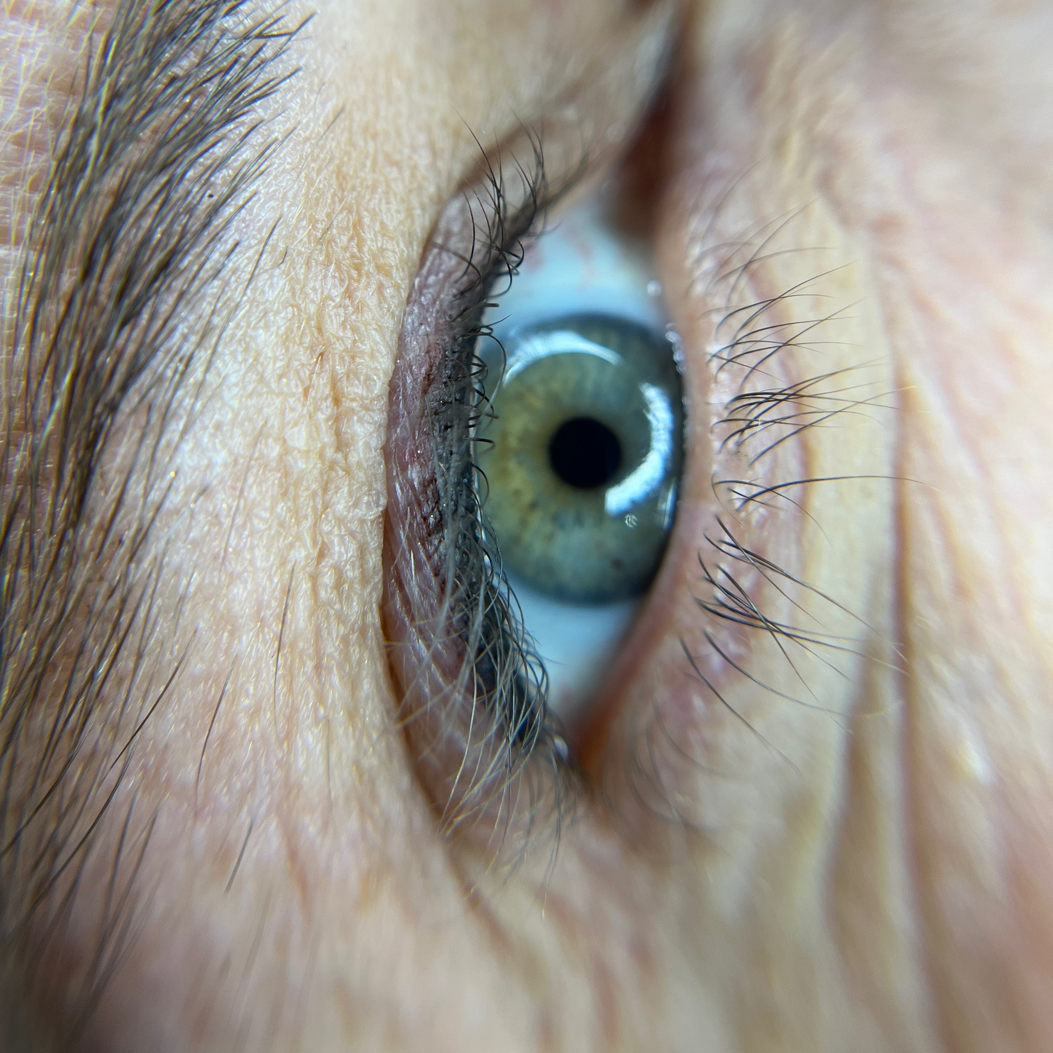 Wimpernkranz