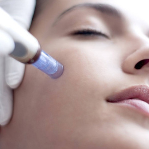 Mikrojehličkování