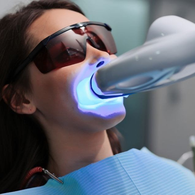 Blanchiment classique DEUXIEME SÉANCE