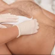 Depilación Superior