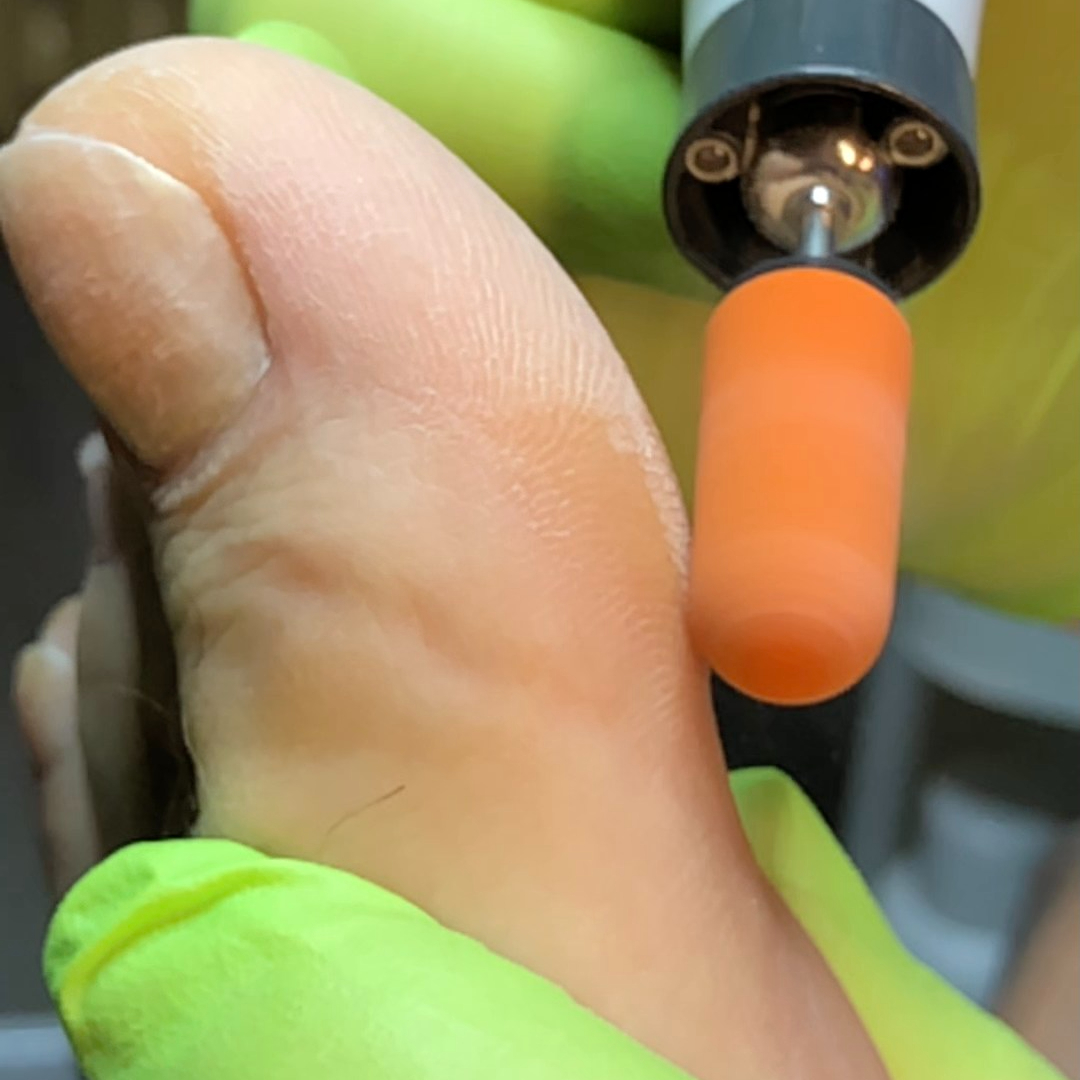 Pedikúra přístrojova