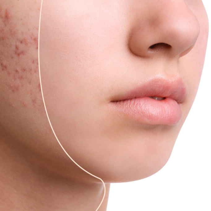 Dermatologická konzultace