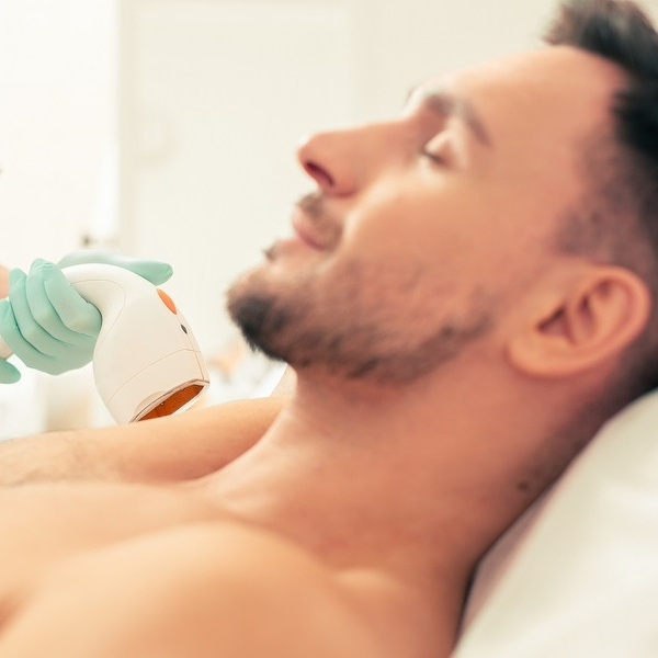 Depilação Laser SHR Ombros