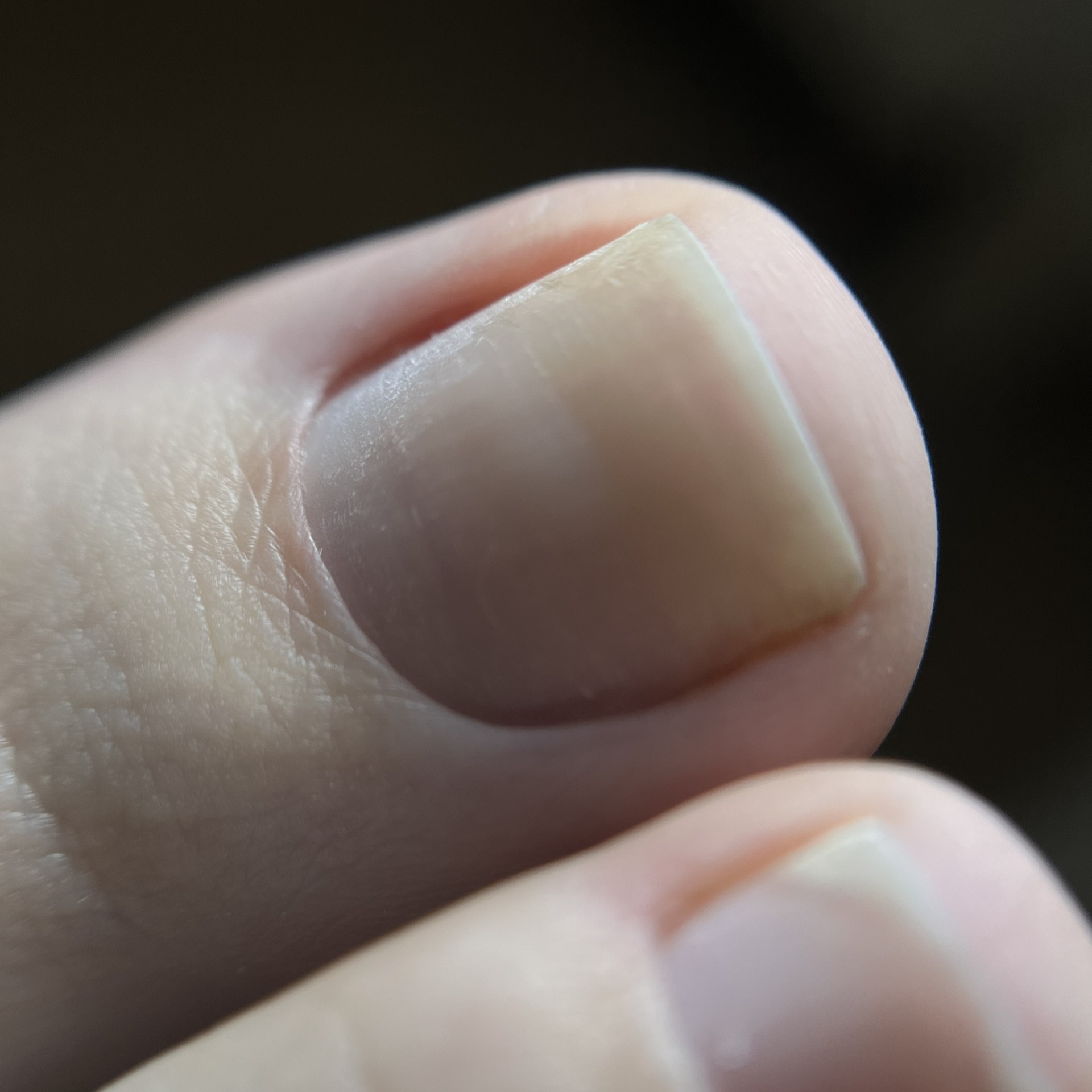 Pédicure - Dépose semi-permanent + pédicure