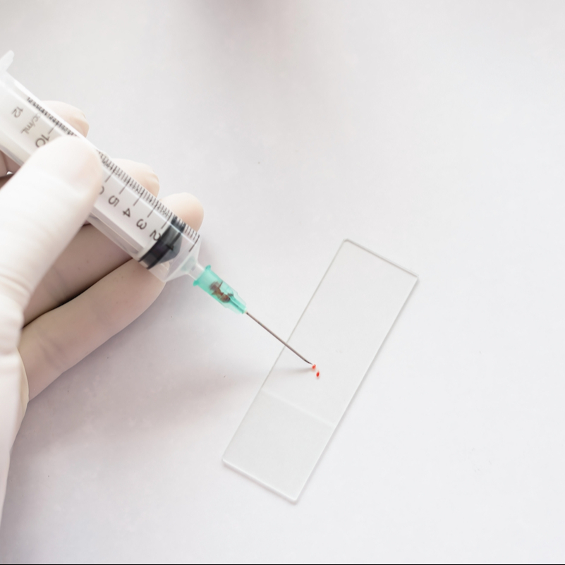 PAAF Punción con aguja fina