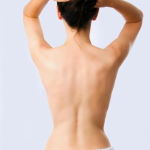 Depilação Laser SHR Costas