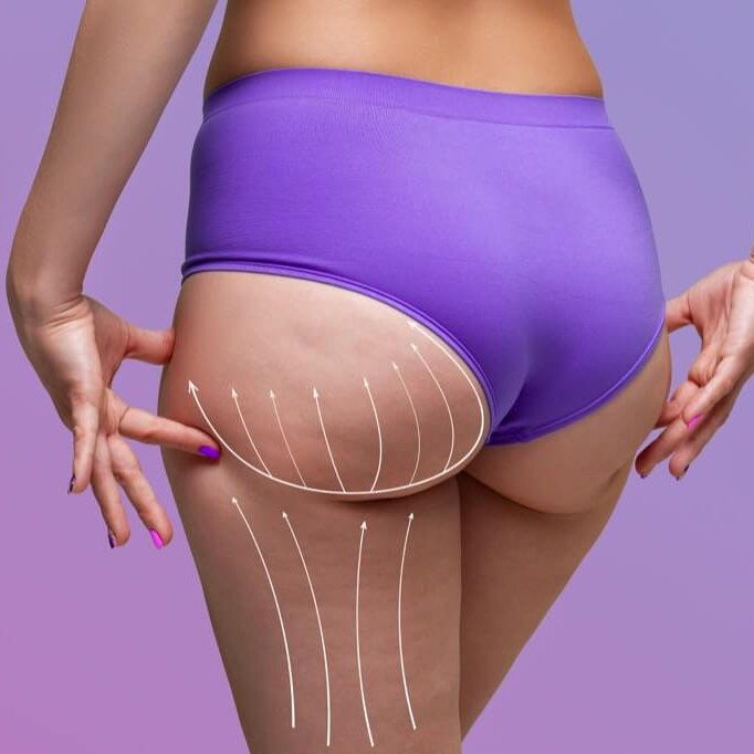 Ošetření LPG tělo a obličej