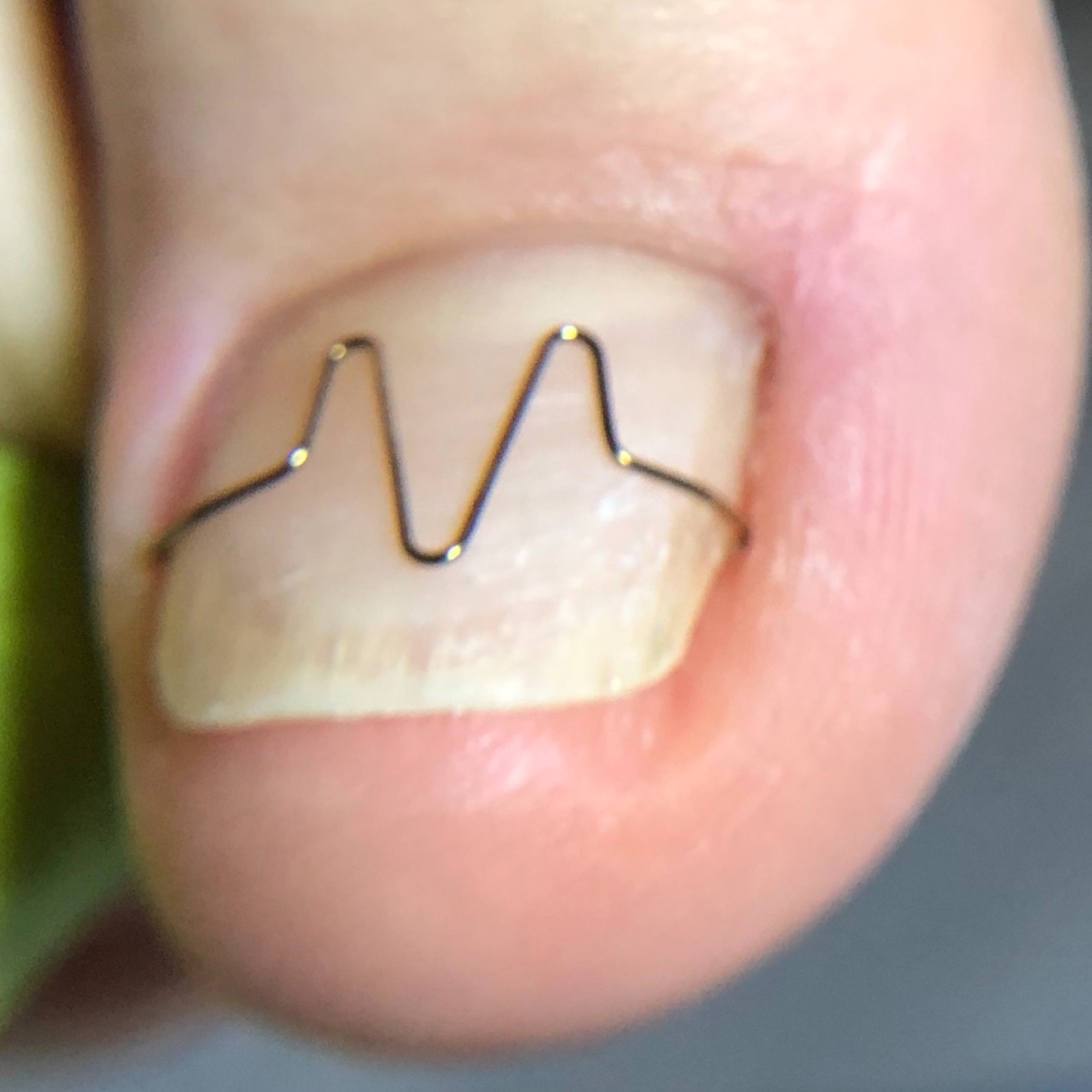 Rovnatka na nehet (1 nehet)