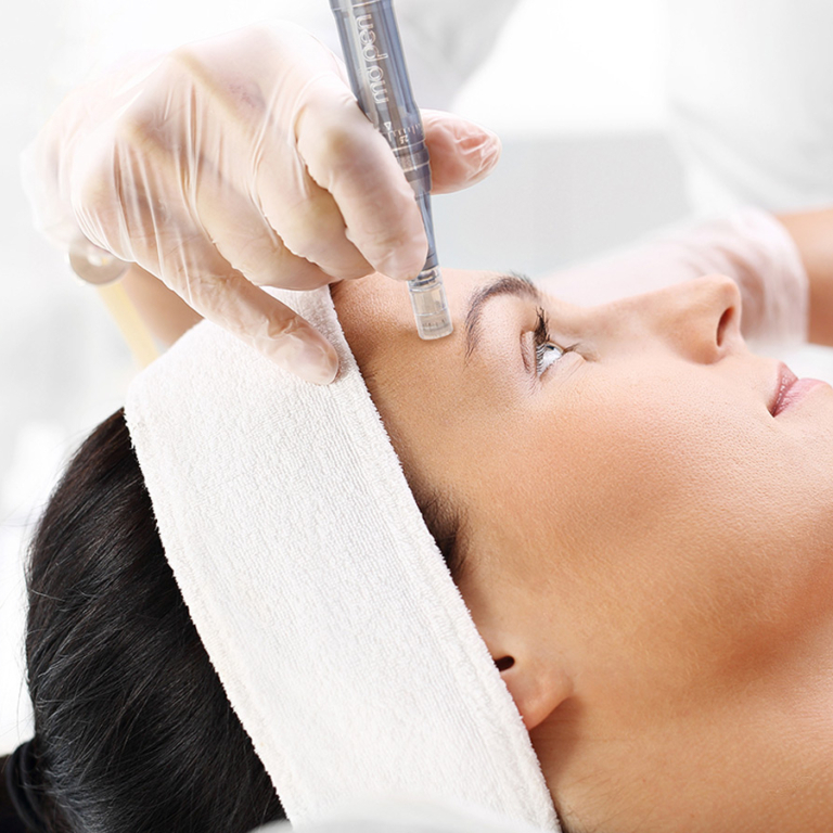 Nanoneedling Mikrojehličkování, bez mikrojehličkování