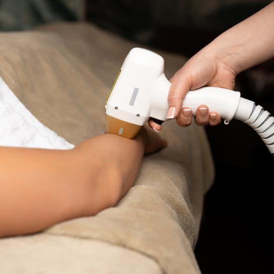 IPL epilace - předloktí